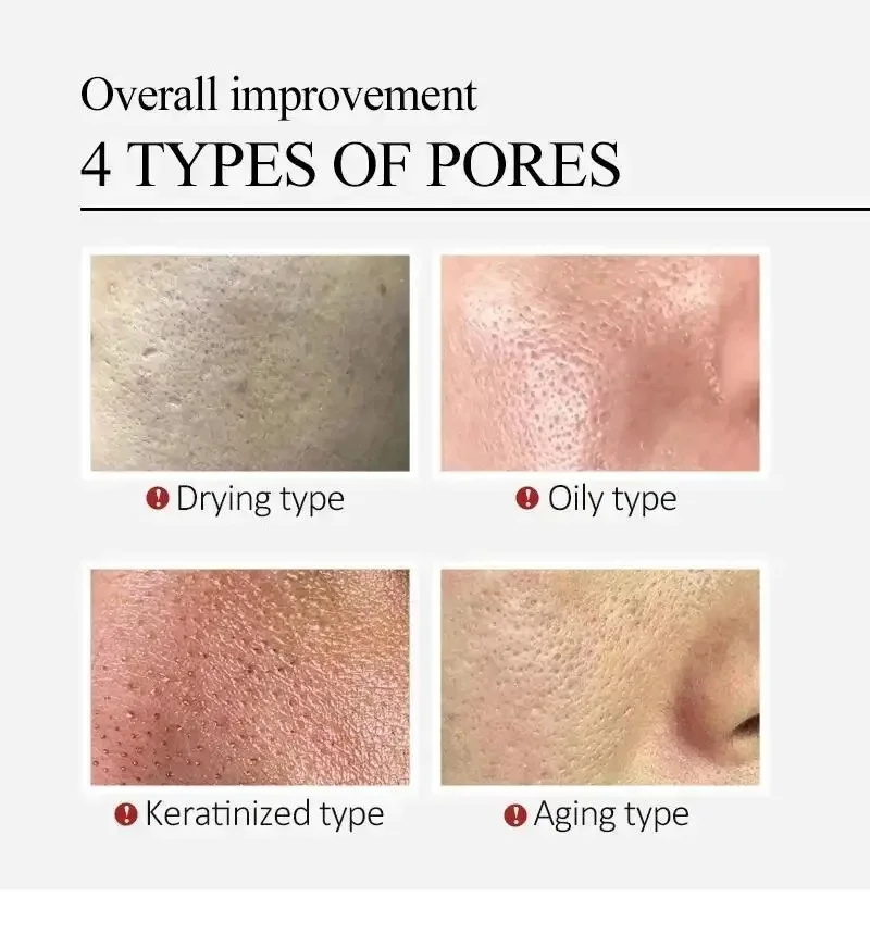 Сыворотка для лица с центеллой – обзор и цена Luxury Skincare Korea